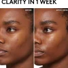 Cherry Dub BHA Toner with Salicylic Acid + Aloe Juice