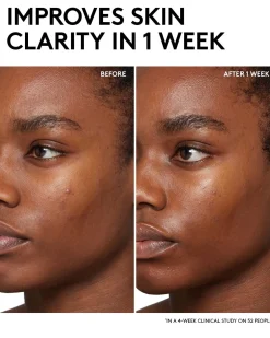 Cherry Dub BHA Toner with Salicylic Acid + Aloe Juice