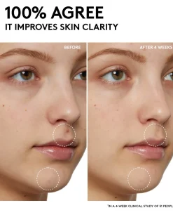 Cherry Dub Pore Purify'r Gel Cleanser with Niacinamide + Aloe Juice